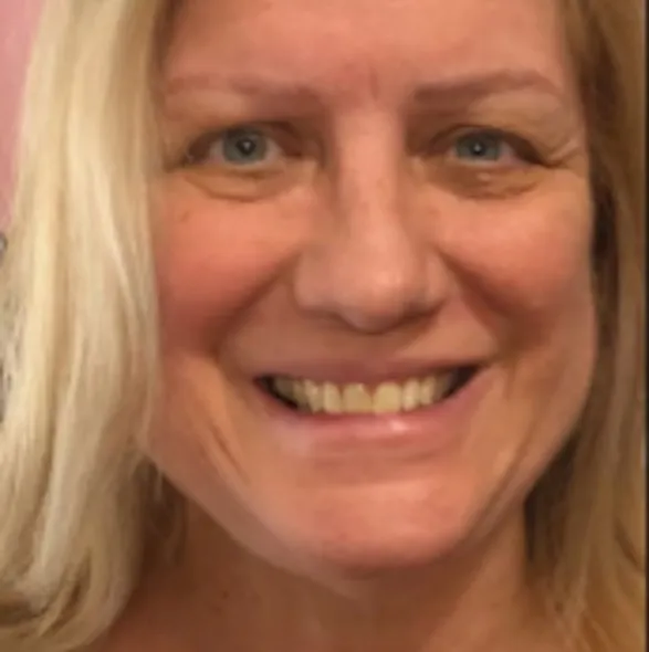 Dr. Lisa French Hinchman - Palm Harbor, FL - Psychiatry