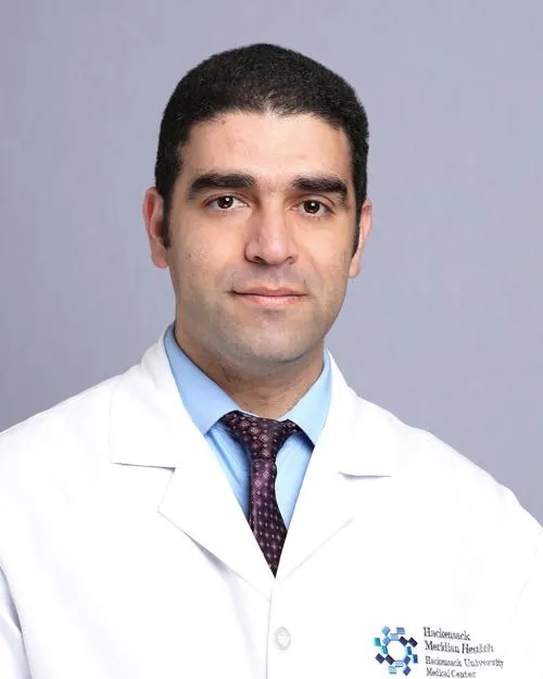 Dr. Osama Mahmoud Abu-Hadid, MD - Hackensack, NJ - Neurology, Movement Disorders Neurology