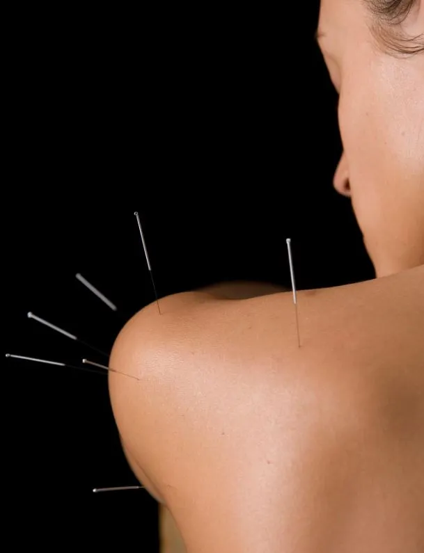 Madhuri Shenker - Burtonsville, MD - Acupuncture