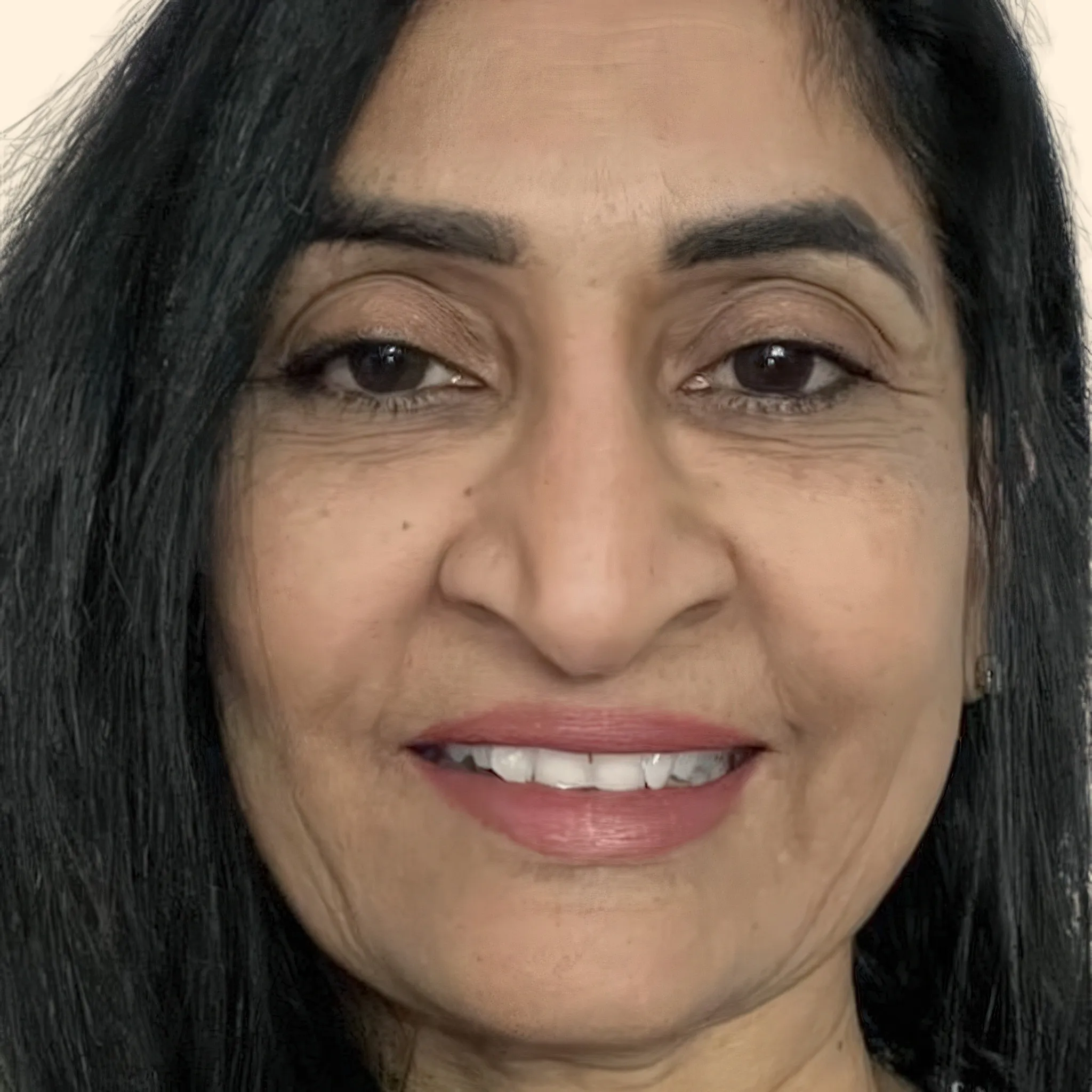 Dr. Usha Ramineni - San Diego, CA - Psychiatry, Addiction Medicine, Mental Health Counseling, Psychologist