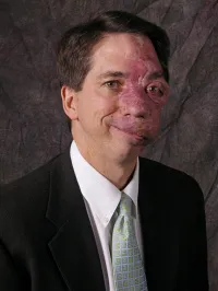Dr. Kevin Jon Miller - Covington, KY - Cardiovascular Disease