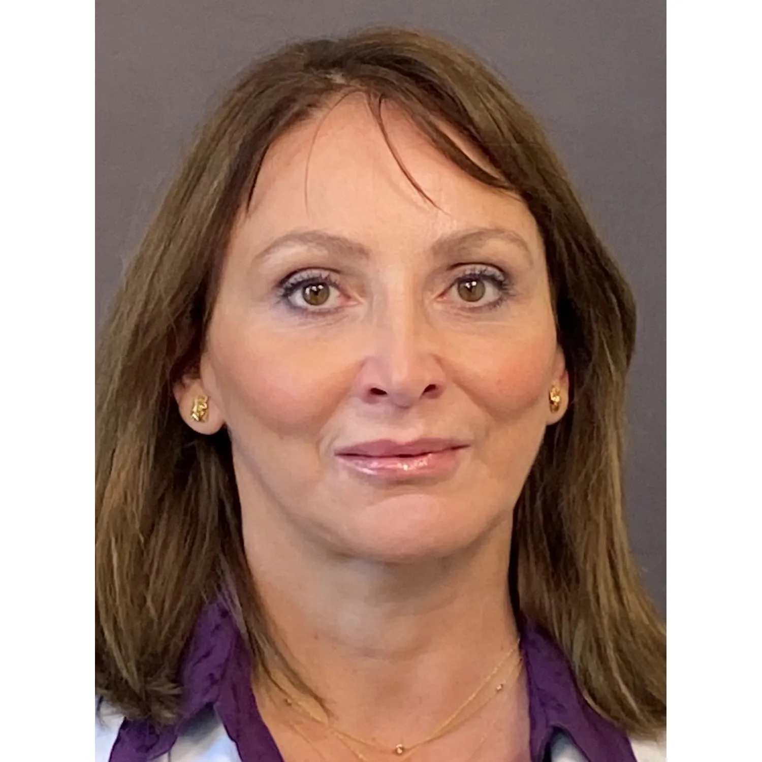 Dr. Andreja Packard, MD - Burlington, VT - Neurology, Neurologist, Sleep Medicine